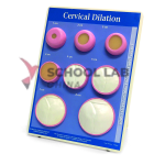 Cervical dilatation model